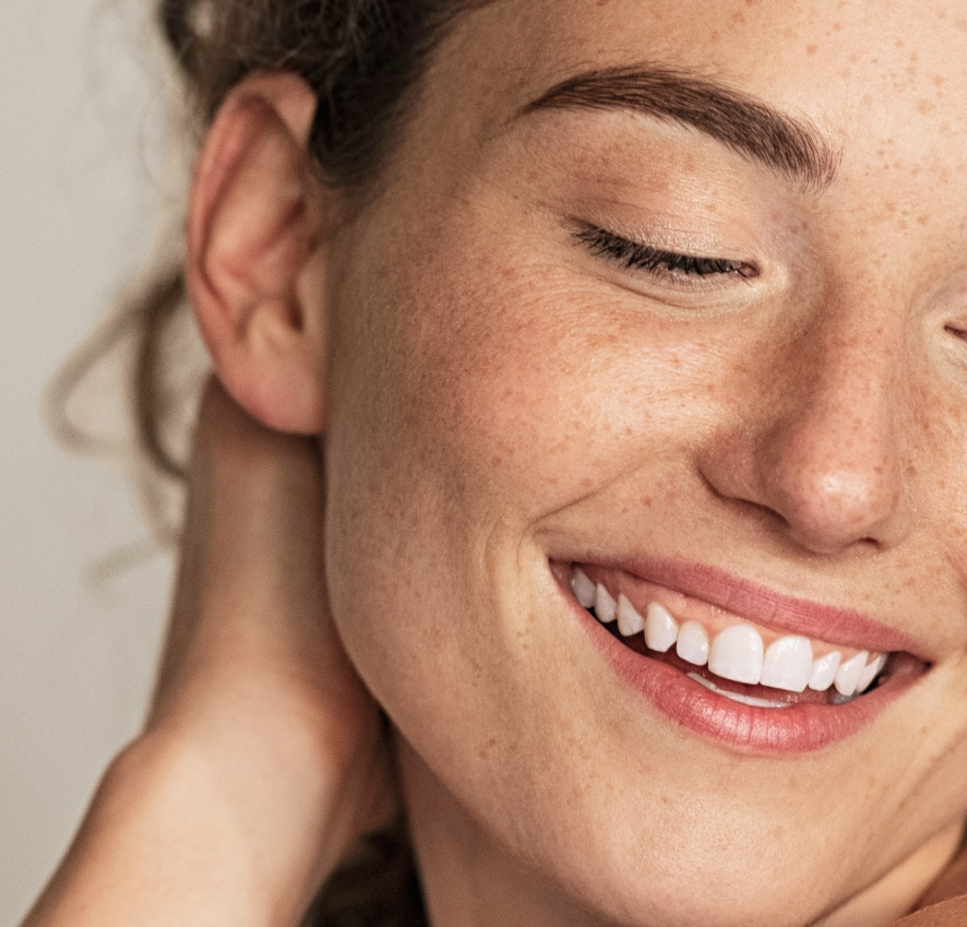 Melasma Reset Program